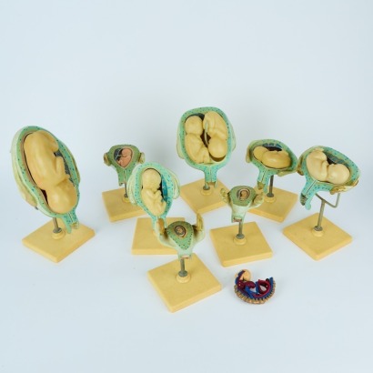 A Set of Scientific Diagrams of the Stages of Foetuses in the Womb