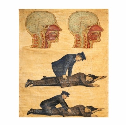An Antique Resuscitation Chart