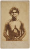 UNKNOWN PHOTOGRAPHER Portrait of Aboriginal woman with nose bone, chest lines, string armbands and woven girdle, wooden stick