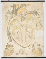 A Vintage Medical Chart of the Heart