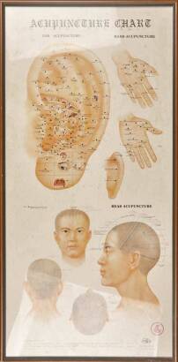 A Framed and Glazed Acupuncture Chart