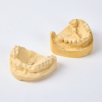 An Orthodontists Cast With Missing Teeth