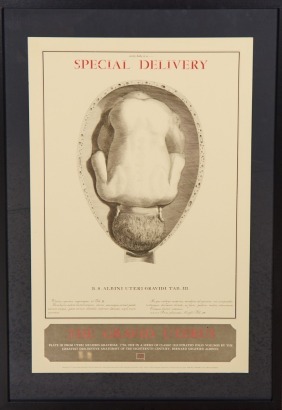 The Gravid Uterus